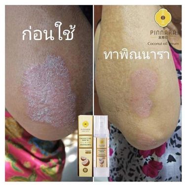 泰國🇹🇭PINNARA coconut oil Serum 椰子油精華液 85ml