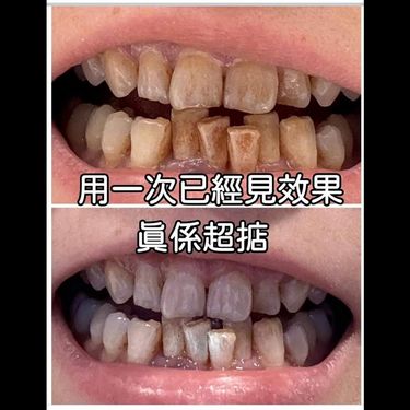 Dr. VITA 超級全效護理牙膏110g
