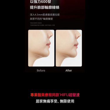 Medicube Age-R High Focus Shot HIFU超音波美容儀❤