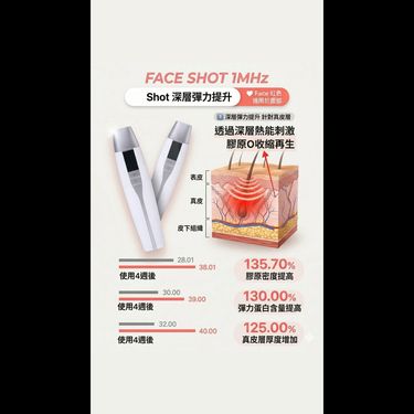 韓國🇰🇷Thermage 機+ 導入Gel 套裝