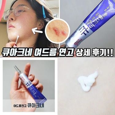 韓國本土藥房熱賣 Q Acne祛痘消炎暗瘡膏15g