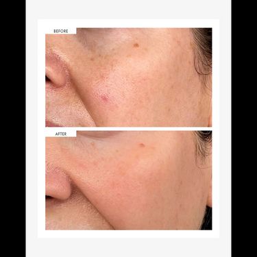 111 SKIN 美白煥顏淡斑精華 Dark Spot Correcting Serum 30ml