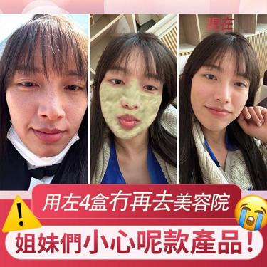 Fatera花青素小氣泡面膜 1盒10包