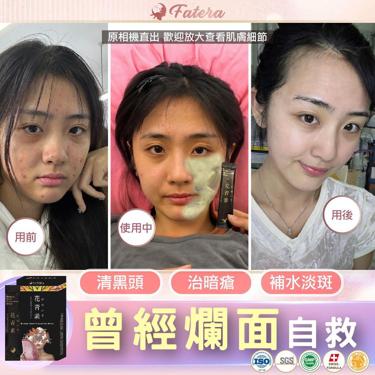 Fatera花青素小氣泡面膜 1盒10包